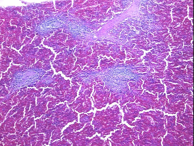 Tissue FFPE Sections, Lymphoid tissue - image 1