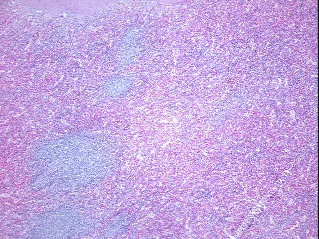 Tissue FFPE Sections, Lymphoid tissue - image 1