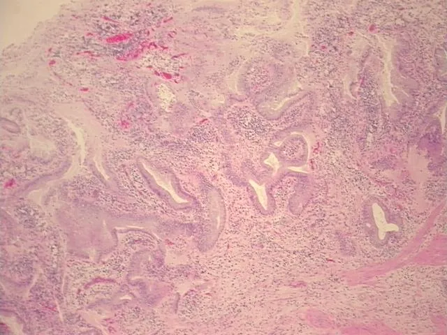 Tissue FFPE Sections, Gallbladder - image 1