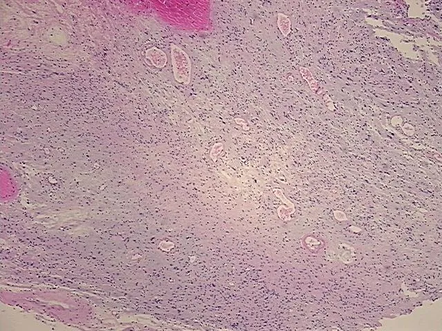 Tissue FFPE Sections, Peripheral nerve - image 1