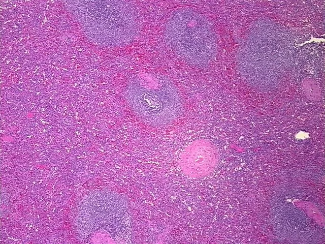 Tissue FFPE Sections, Spleen - image 1