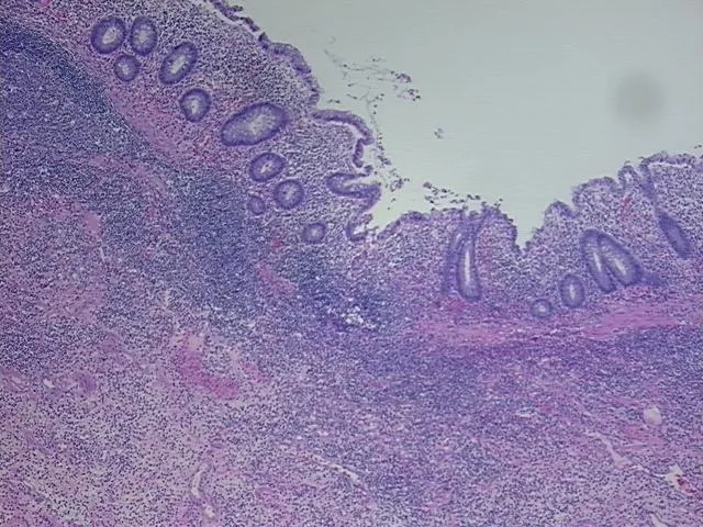Tissue FFPE Sections, Appendix - image 1