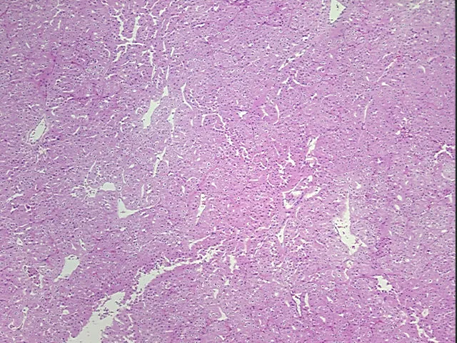 Tissue FFPE Sections, Kidney - image 1
