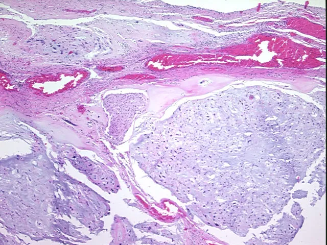 Tissue FFPE Sections, Neural tissue - image 1