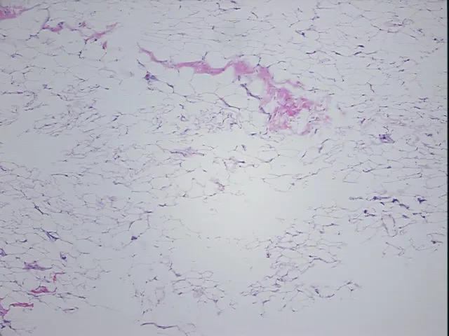Tissue FFPE Sections, Adipose tissue - image 1