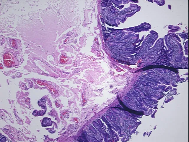 Tissue FFPE Sections, Jejunum - image 1