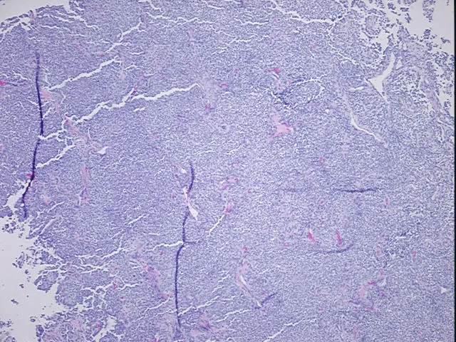 Tissue FFPE Sections, Ovary: left - image 1