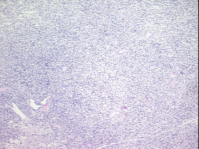 Tissue FFPE Sections, Kidney - image 1