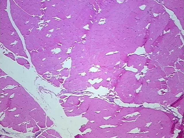 Tissue FFPE Sections, Muscle tissue - image 1
