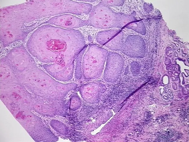 Tissue FFPE Sections, Vulva - image 1