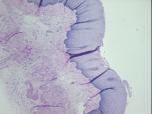 Tissue FFPE Sections, Esophagus - image 1