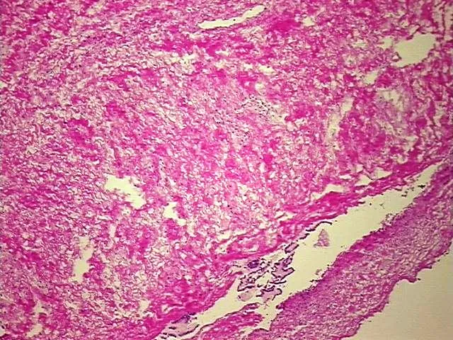 Tissue FFPE Sections, Lymphoid tissue - image 1