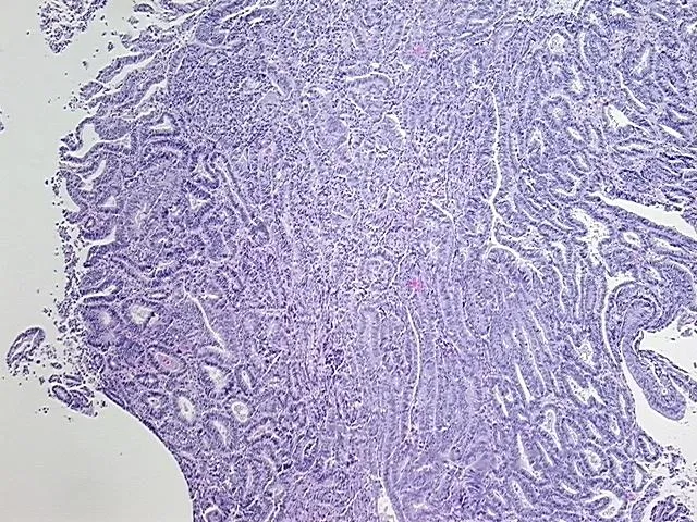 Tissue FFPE Sections, Endometrium - image 1
