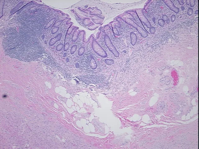 Tissue FFPE Sections, Appendix - image 1