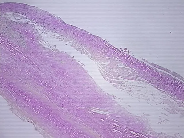 Tissue FFPE Sections, Aorta - image 1