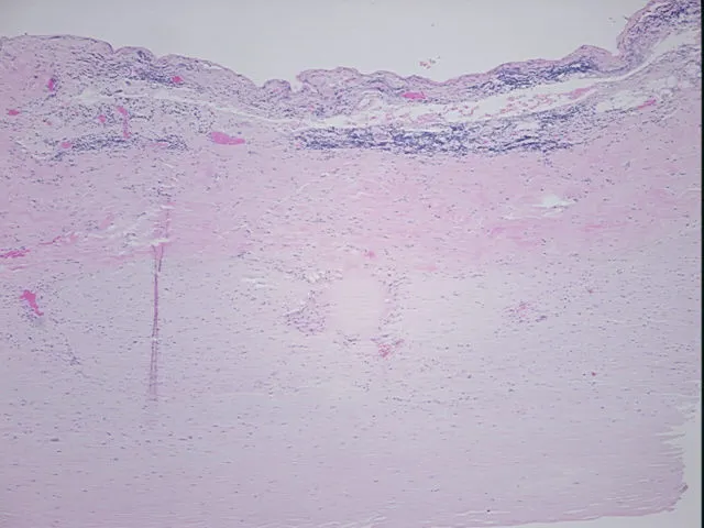 Tissue FFPE Sections, Aorta - image 1