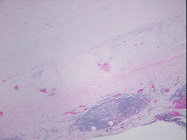 Tissue FFPE Sections, Aorta - image 1