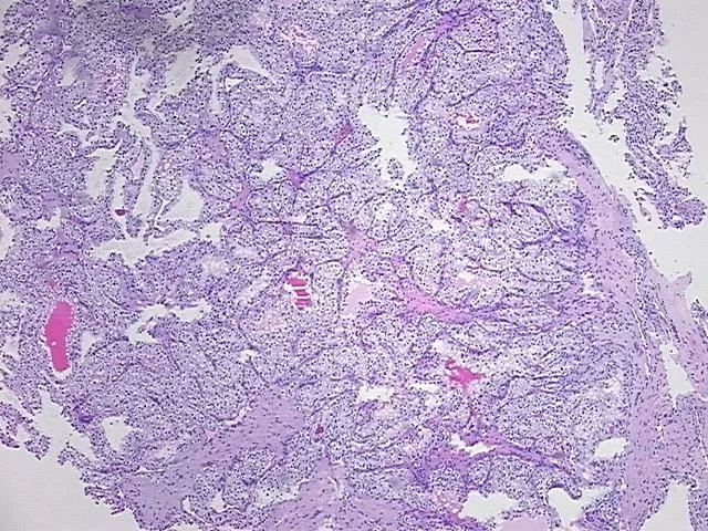 Tissue FFPE Sections, Kidney - image 1