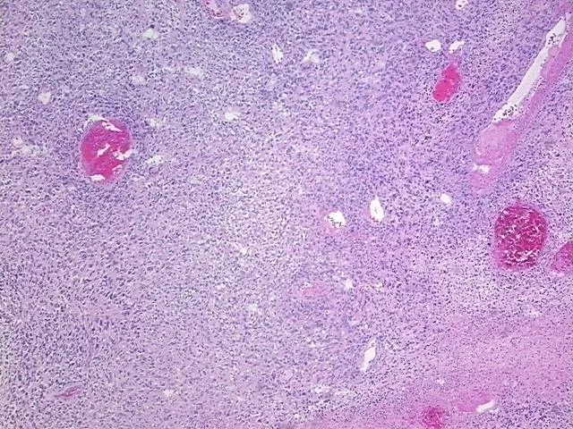 Tissue FFPE Sections, Endometrium - image 1