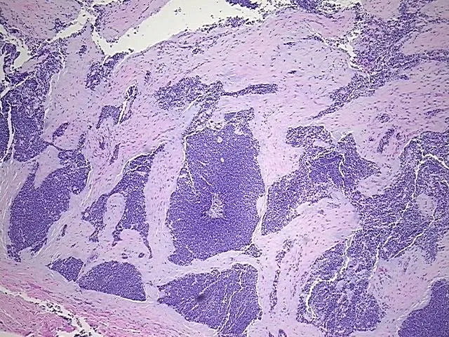 Tissue FFPE Sections, Unknown tissue - image 1