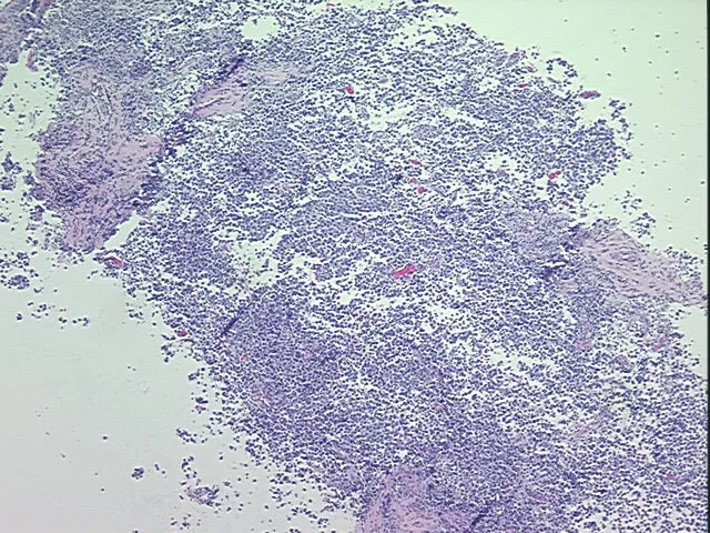 Tissue FFPE Sections, Testis - image 1