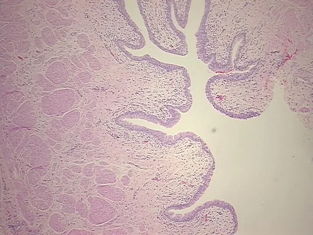Tissue FFPE Sections, Ureter - image 1