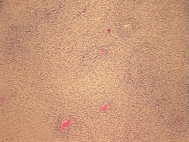 Tissue FFPE Sections, Soft tissue - image 1