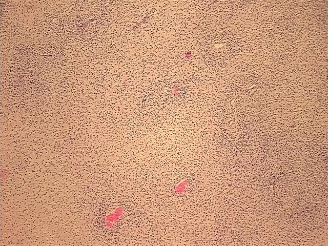 Tissue FFPE Sections, Soft tissue - image 1