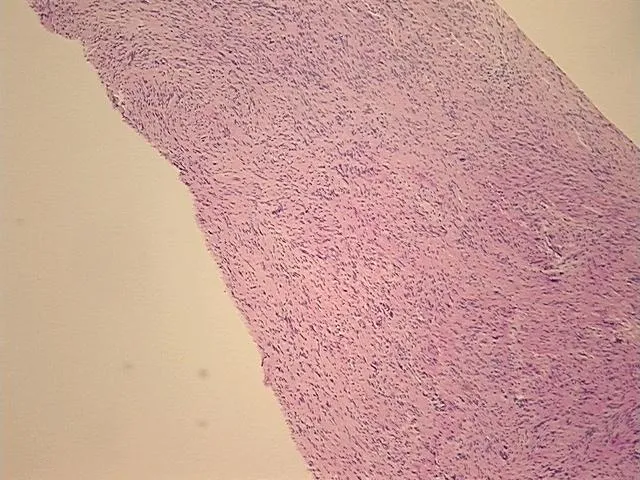 Tissue FFPE Sections, Spinal cord - image 1