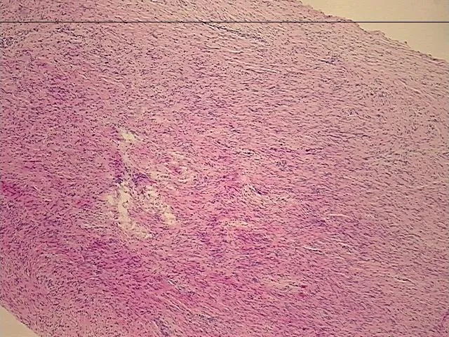 Tissue FFPE Sections, Spinal cord - image 1