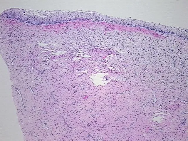 Tissue FFPE Sections, Cervix - image 1