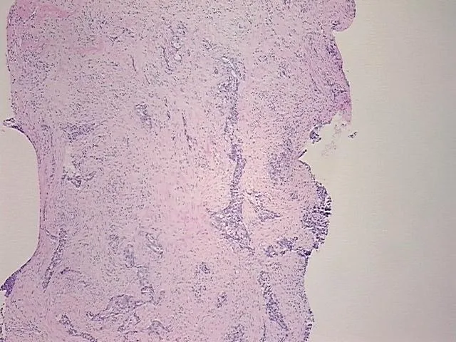 Tissue FFPE Sections, Colon - image 1