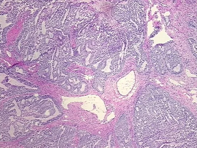 Tissue FFPE Sections, Colon - image 1