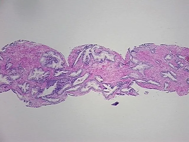 Tissue FFPE Sections, Prostate - image 1