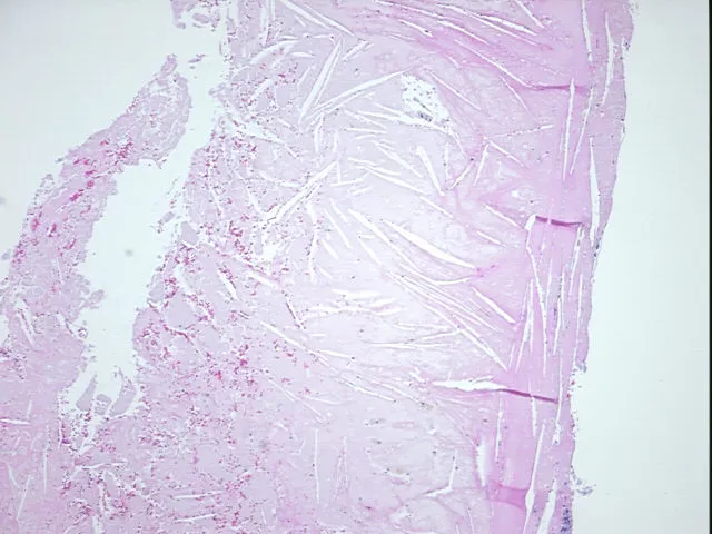 Tissue FFPE Sections, Aorta - image 1