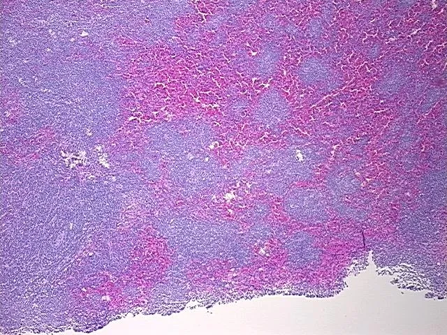 Tissue FFPE Sections, Lymphoid tissue - image 1