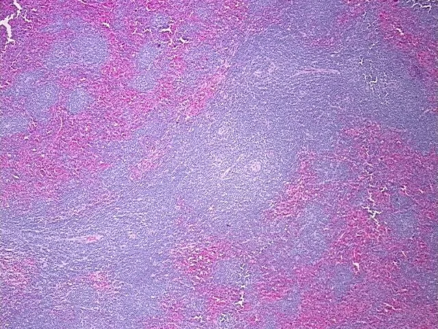 Tissue FFPE Sections, Lymphoid tissue - image 1