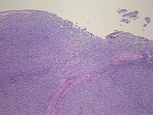 Tissue FFPE Sections, Lymphoid tissue - image 1