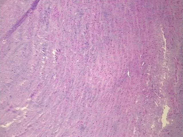 Tissue FFPE Sections, Aorta - image 1