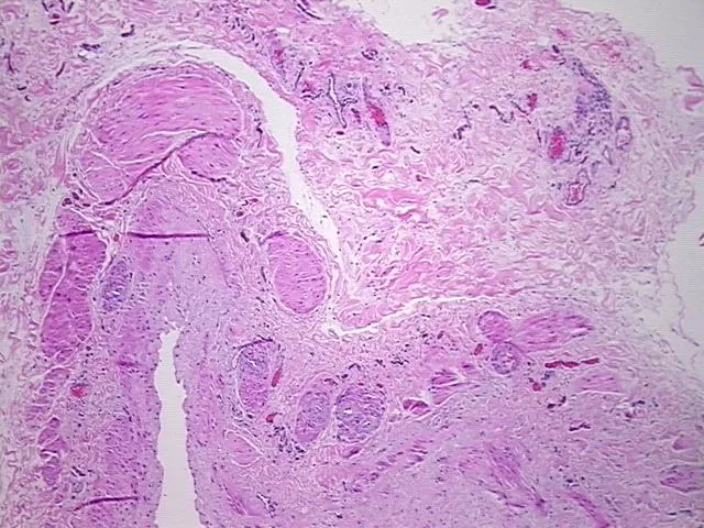Tissue FFPE Sections, Vein - image 1