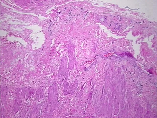 Tissue FFPE Sections, Vein - image 1
