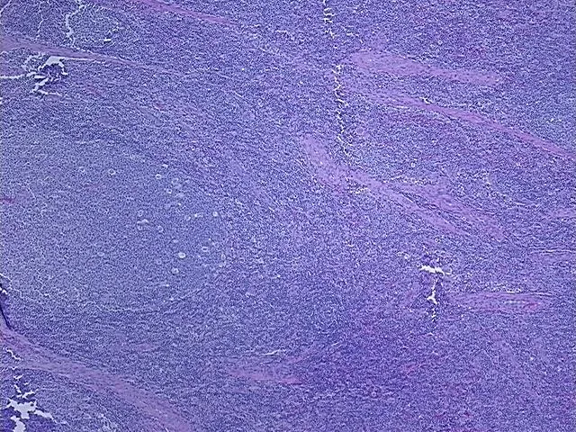 Tissue FFPE Sections, Lymph node - image 1
