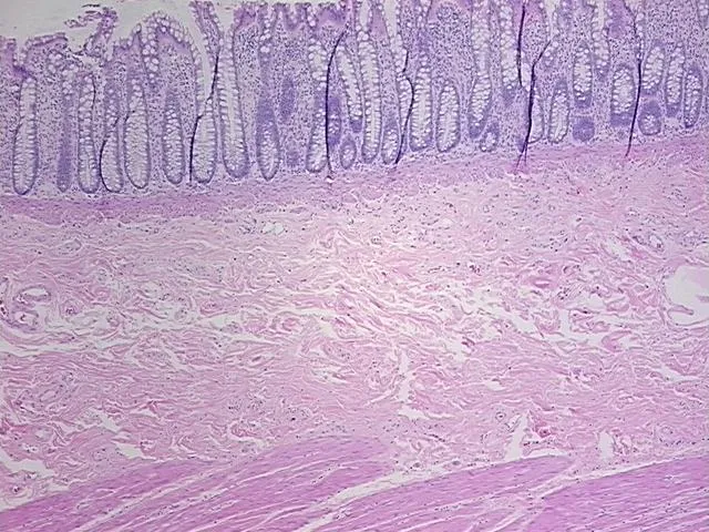 Tissue FFPE Sections, Rectum - image 1