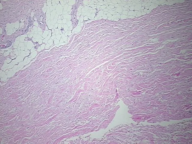 Tissue FFPE Sections, Soft tissue - image 1