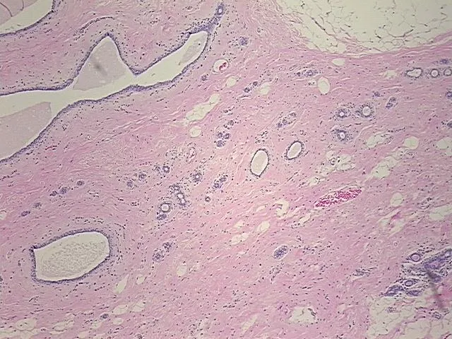 Tissue FFPE Sections, Breast - image 1