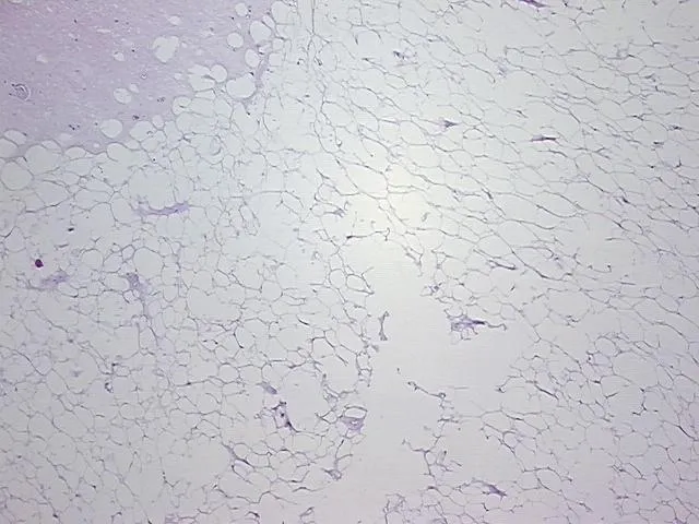 Tissue FFPE Sections, Soft tissue - image 1
