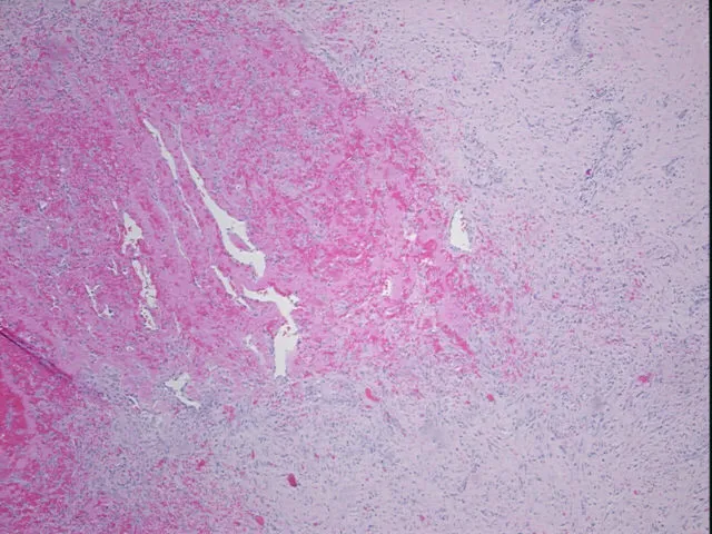Tissue FFPE Sections, Soft tissue - image 1