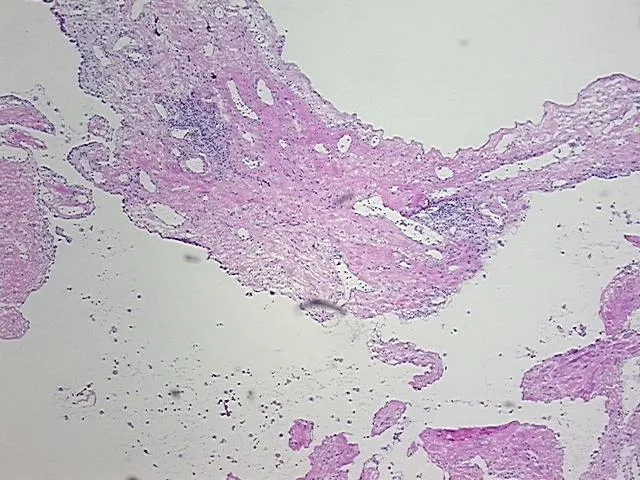 Tissue FFPE Sections, Soft tissue - image 1
