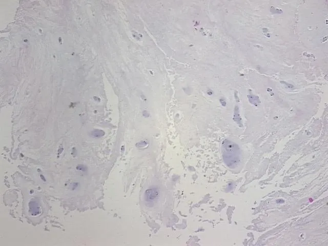 Tissue FFPE Sections, Intervertebral disc - image 1