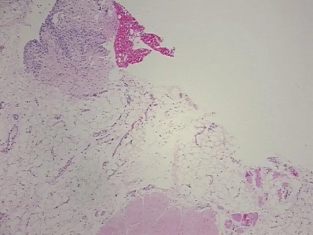 Tissue FFPE Sections, Joint - image 1